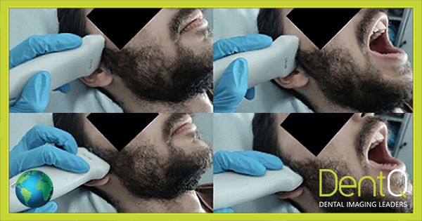 Ultrasound Scan – Maxillofacial