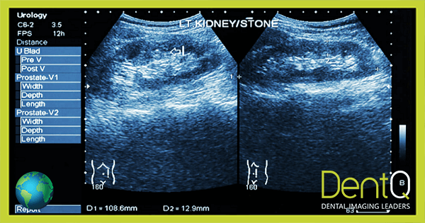 Ultrasound Scan – Results and Interpretation