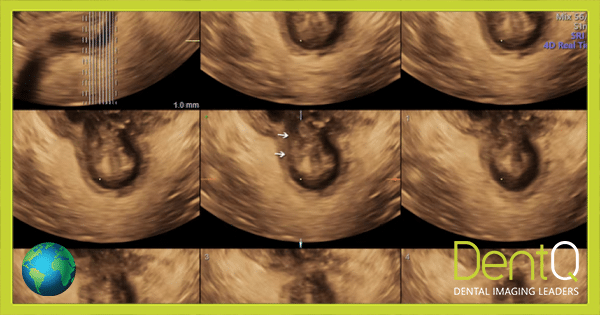 Ultrasound Scan – Urinary and Pelvic